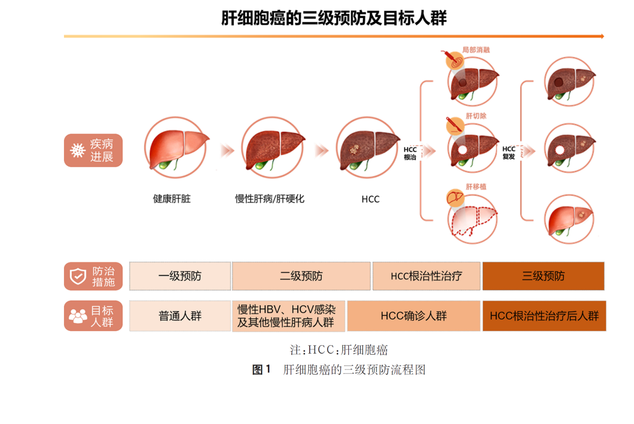 原發(fā)性肝癌三級(jí)預(yù)防共識(shí)（2022年版）指出復(fù)方鱉甲軟肝片有助于降低肝癌復(fù)發(fā)風(fēng)險(xiǎn)
